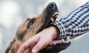 How Our Las Vegas Personal Injury Lawyers Can Help If You’ve Been Attacked By a Dog